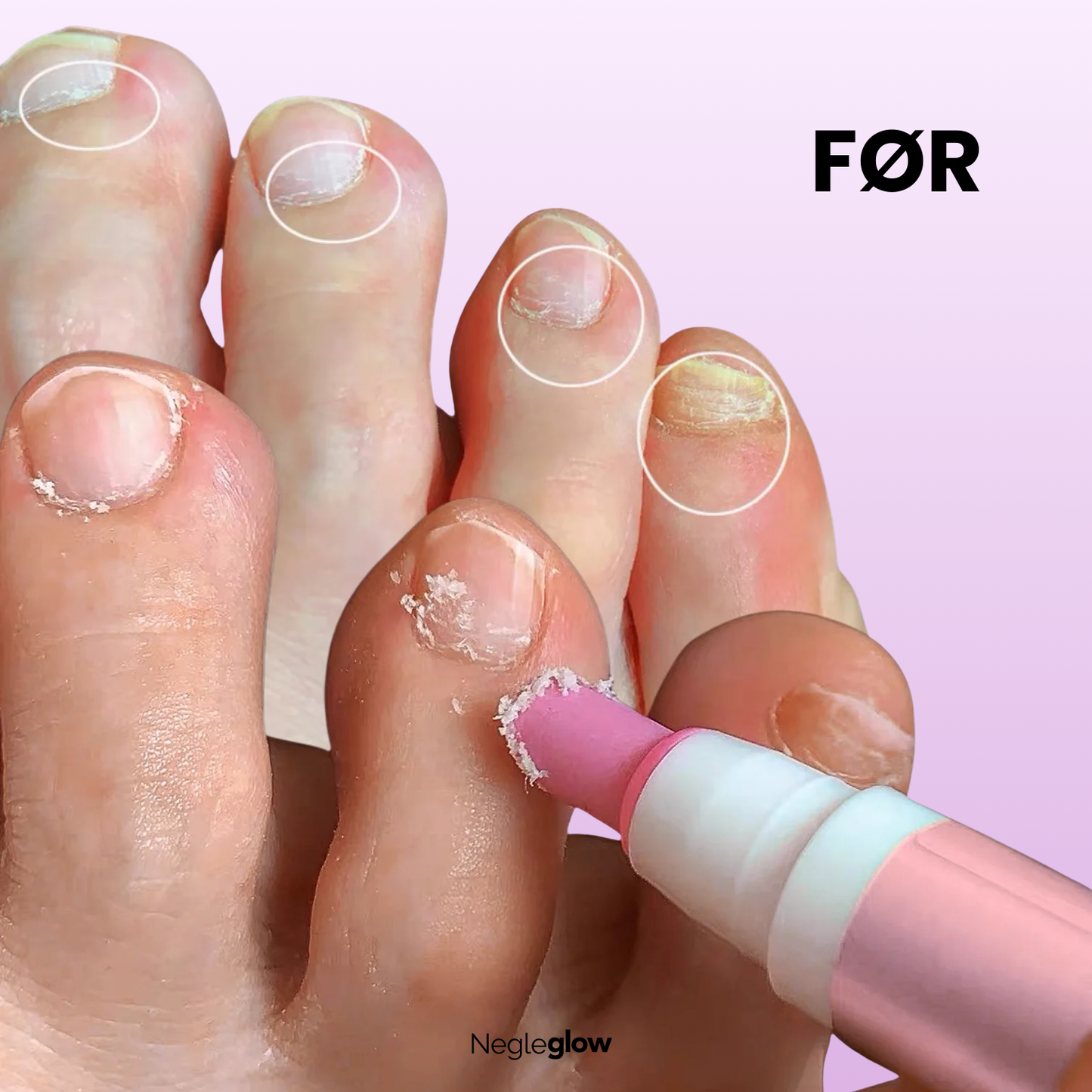 NegleGlow - Få silkemyke neglebånd