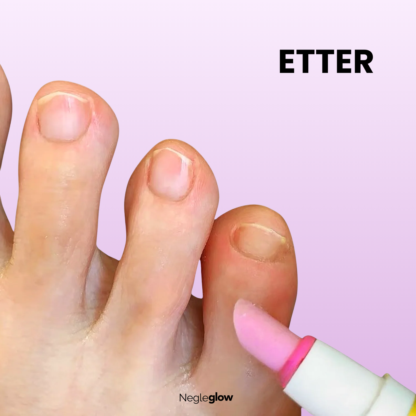 NegleGlow - Få silkemyke neglebånd